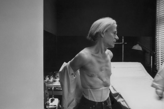 Andy Warhol wearing his surgical corset