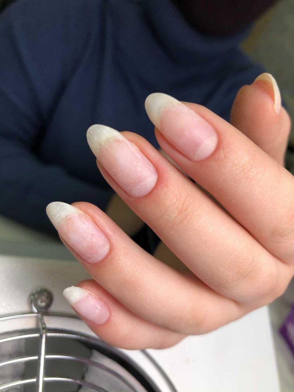 Кутикула у ногтей