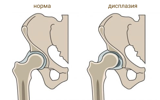Заболевания суставов